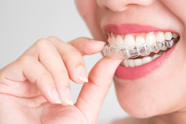 Invisalign-site (otimnizada)