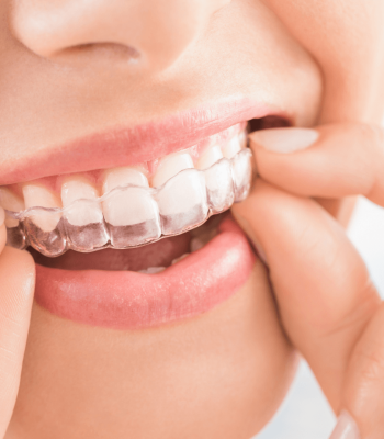 invisaling_foto_otimizada